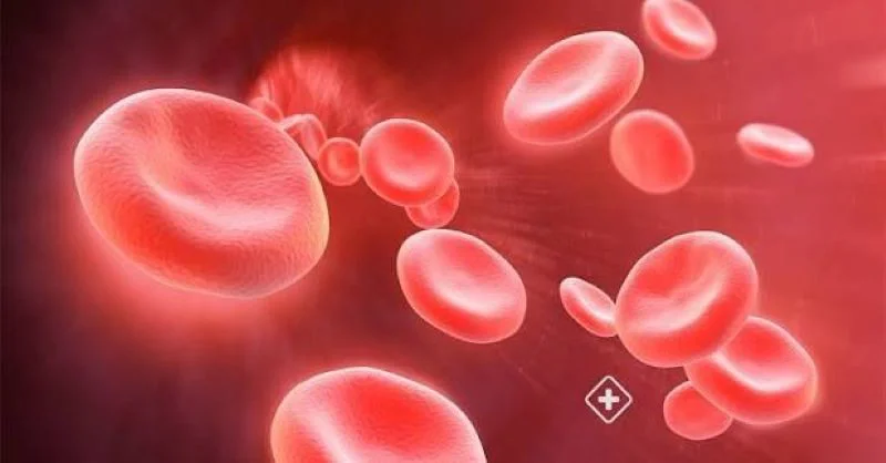 anemia