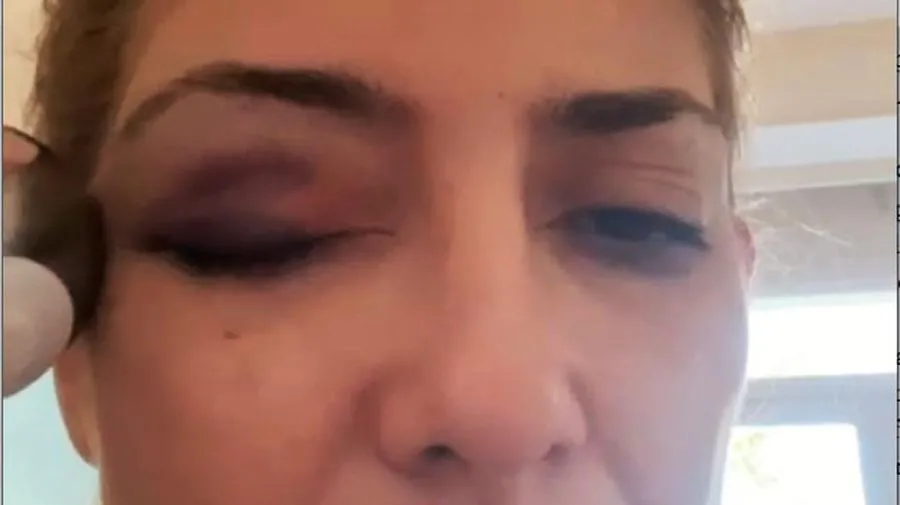 fabiola yanez golpes