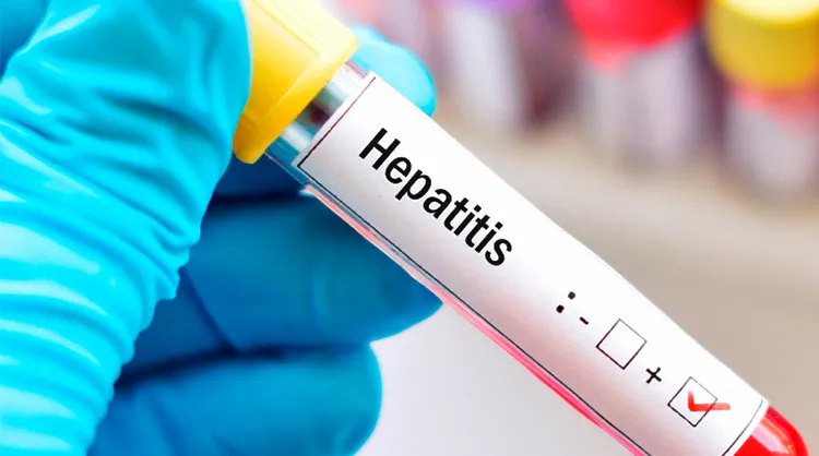 Hepatitis